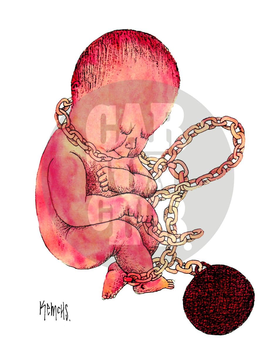 Cordón umbilical, cartón de Kemchs