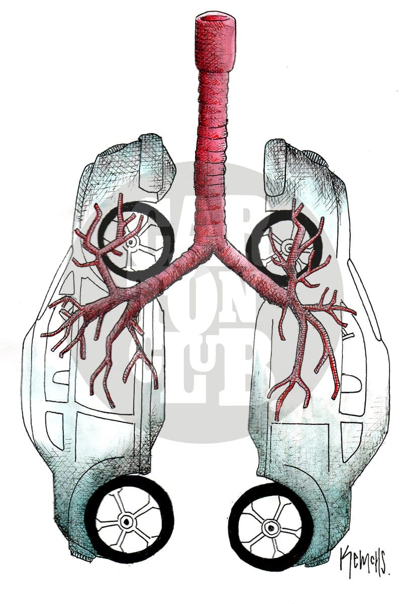 Enfermedades pulmonares, cartón de Kemchs