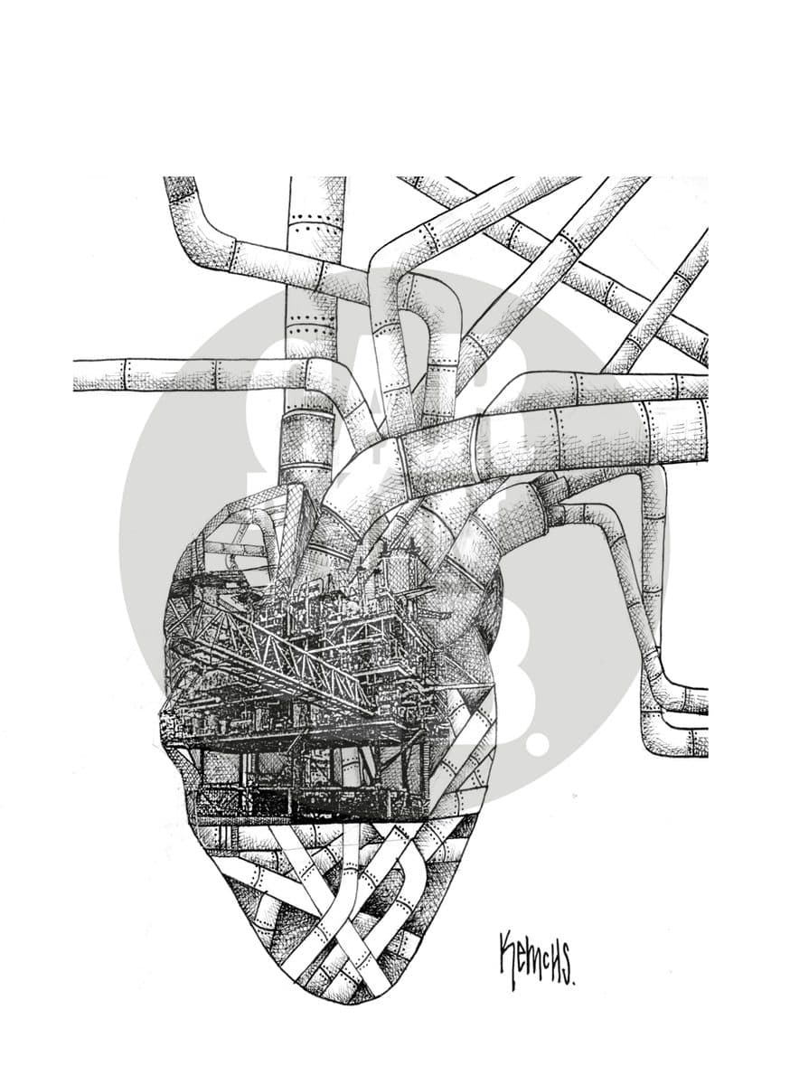 Infarto, cartón de Kemchs