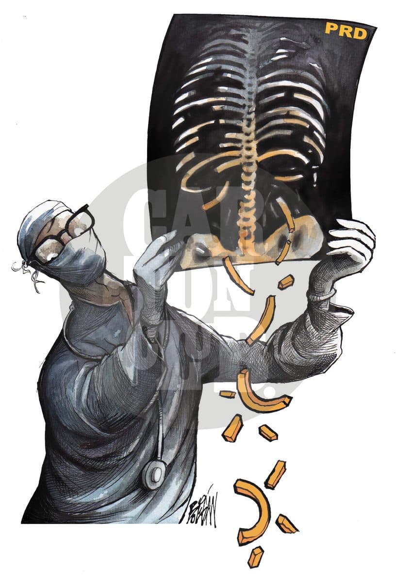 Radiografía